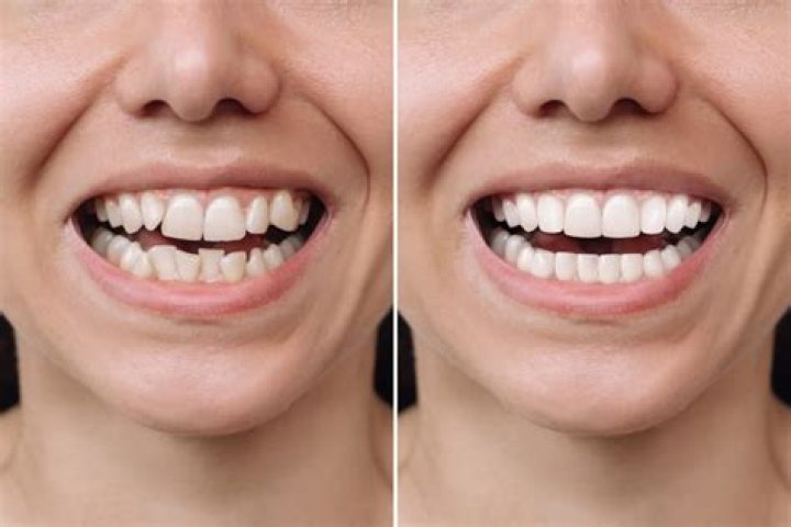 A Journey To Dazzling Smiles