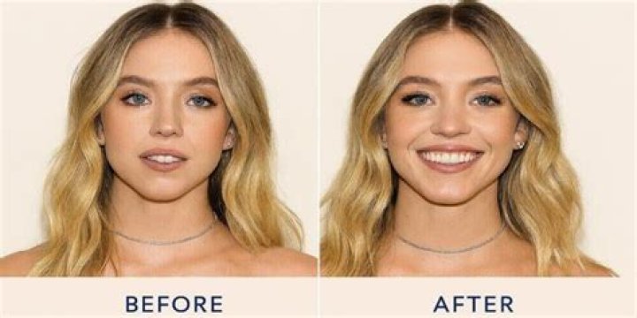 Sydney Sweeney Weight Loss Before And After: Health Update