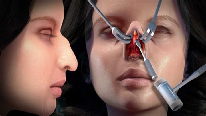 Unveiling The Truths Behind Jessica Alba's Rhinoplasty Journey